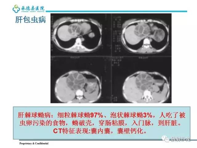 【PPT】肝脏常见占位性病变影像表现及诊断思路