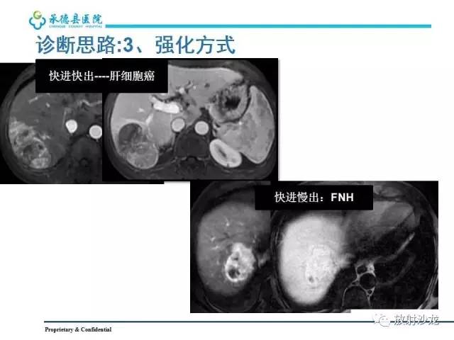 【PPT】肝脏常见占位性病变影像表现及诊断思路