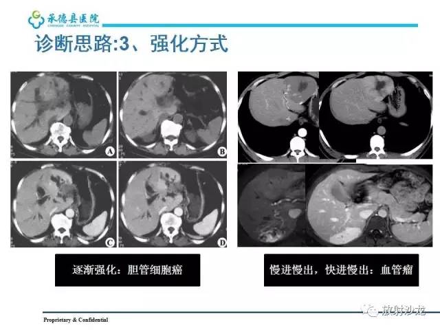 【PPT】肝脏常见占位性病变影像表现及诊断思路
