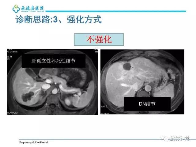 【PPT】肝脏常见占位性病变影像表现及诊断思路
