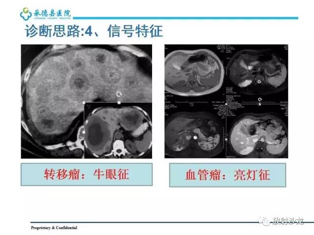 【PPT】肝脏常见占位性病变影像表现及诊断思路