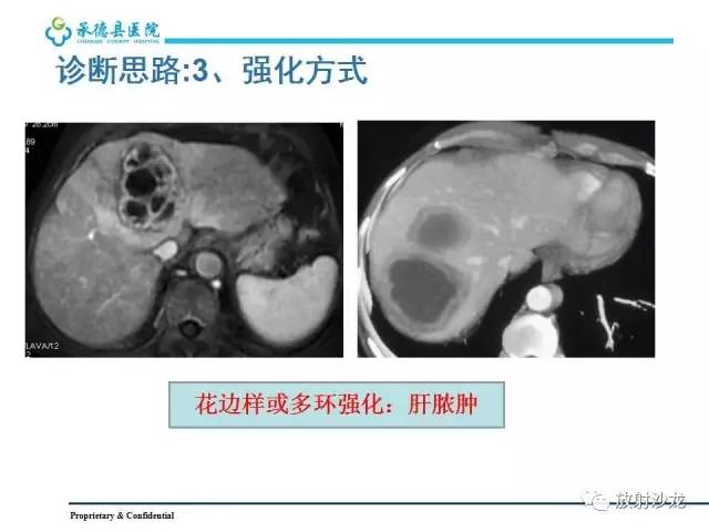 【PPT】肝脏常见占位性病变影像表现及诊断思路