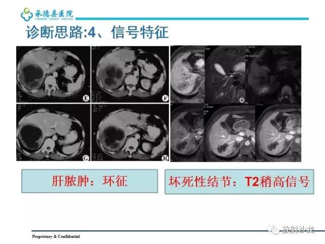 【PPT】肝脏常见占位性病变影像表现及诊断思路