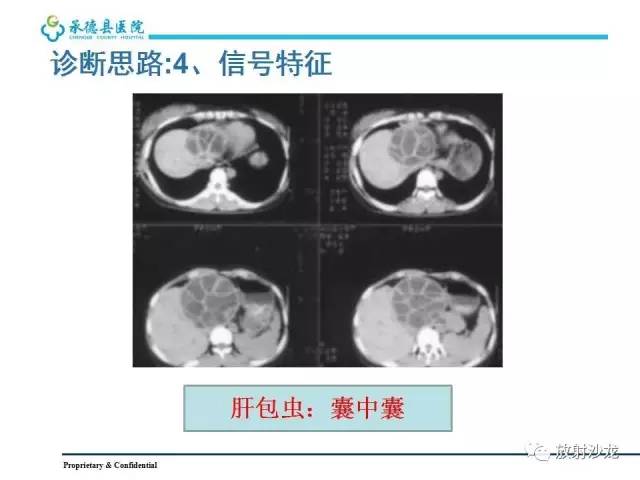 【PPT】肝脏常见占位性病变影像表现及诊断思路