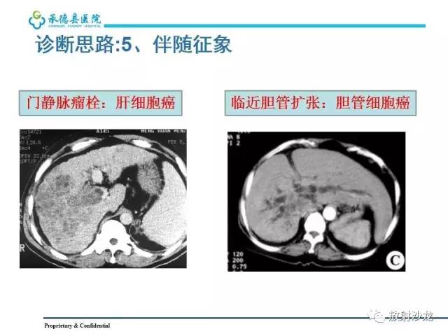 【PPT】肝脏常见占位性病变影像表现及诊断思路