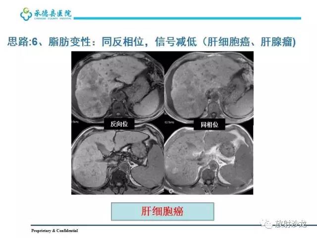 【PPT】肝脏常见占位性病变影像表现及诊断思路