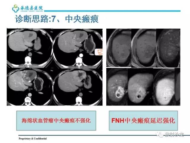 【PPT】肝脏常见占位性病变影像表现及诊断思路