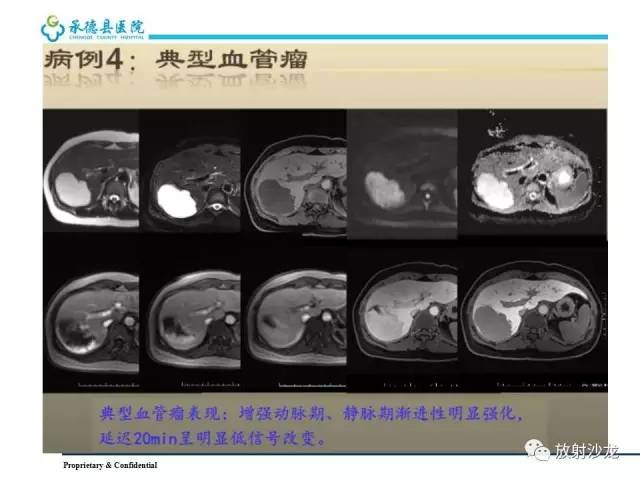 【PPT】肝脏常见占位性病变影像表现及诊断思路