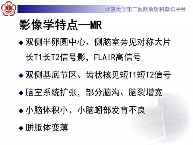 【病例】科凯恩综合征1例CT及MR