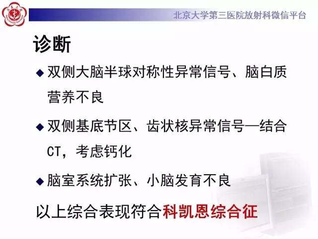 【病例】科凯恩综合征1例CT及MR