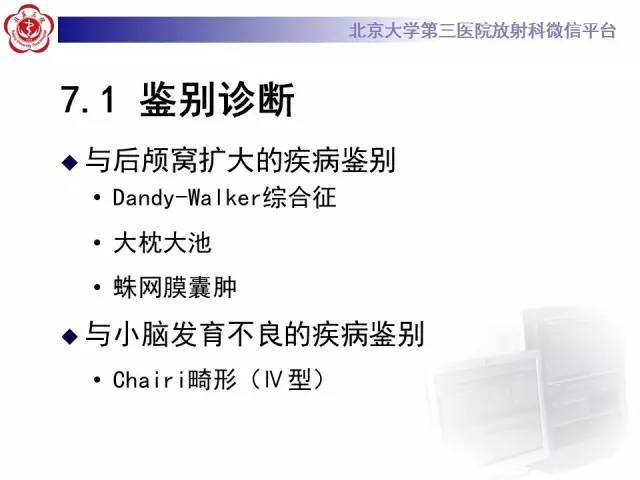 【病例】科凯恩综合征1例CT及MR