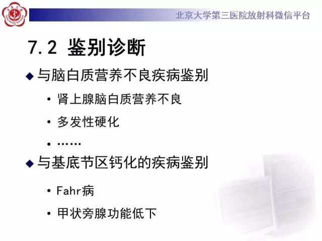 【病例】科凯恩综合征1例CT及MR
