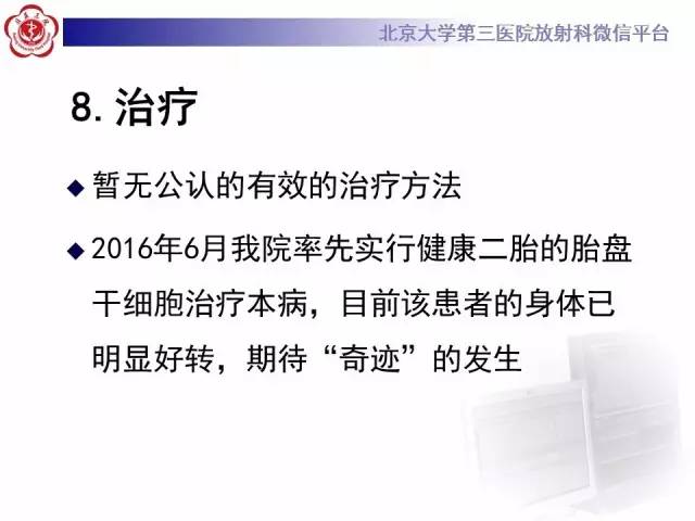 【病例】科凯恩综合征1例CT及MR