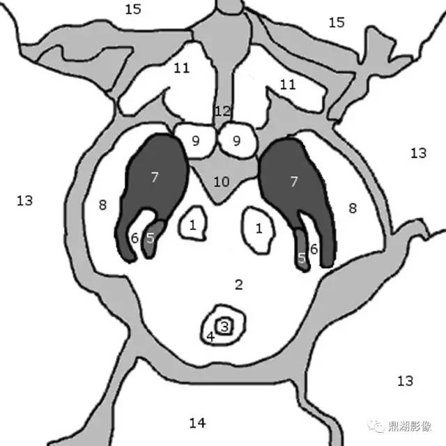 帕金森——从燕尾缺失征开始谈一谈 帕金森——从燕尾缺失征开始谈一谈