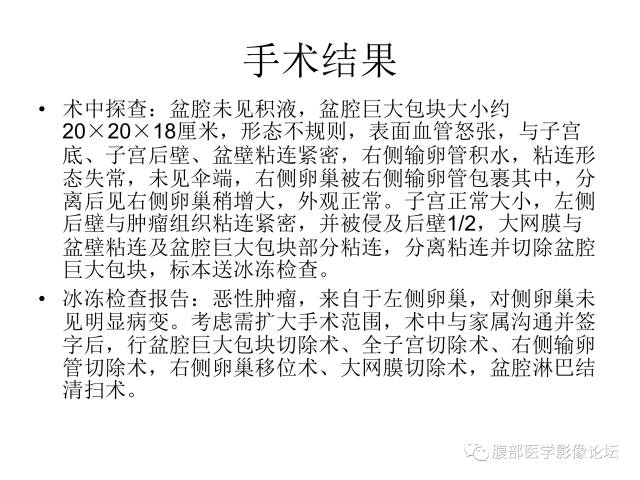 【病例】卵巢无性细胞瘤1例CT影像表现 【病例】卵巢无性细胞瘤1例CT影像表现