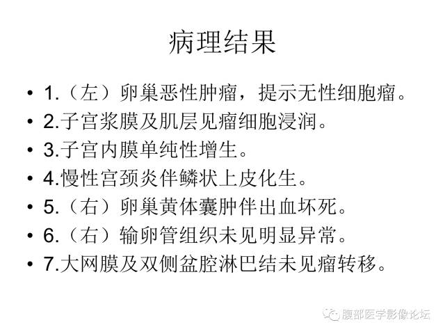 【病例】卵巢无性细胞瘤1例CT影像表现 【病例】卵巢无性细胞瘤1例CT影像表现