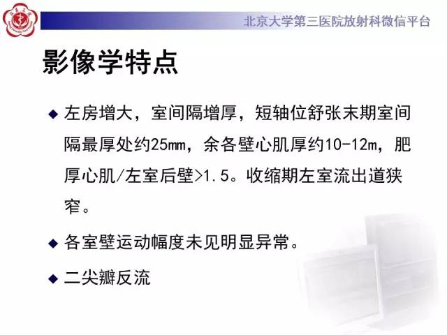 【病例】肥厚性心肌病1例MR影像表现