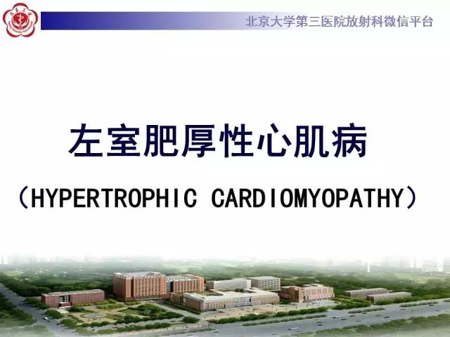 【病例】肥厚性心肌病1例MR影像表现