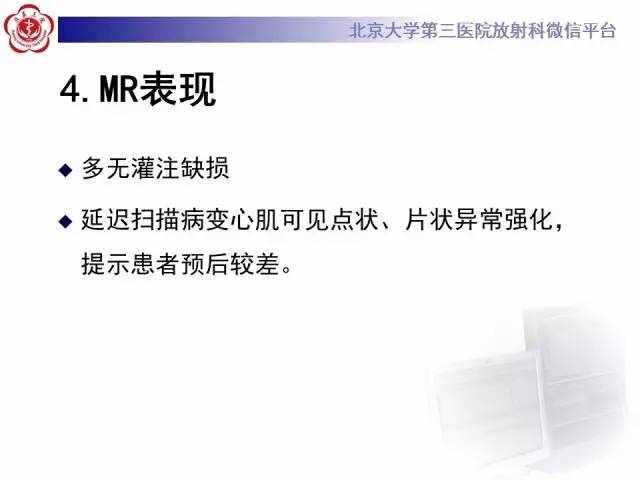 【病例】肥厚性心肌病1例MR影像表现