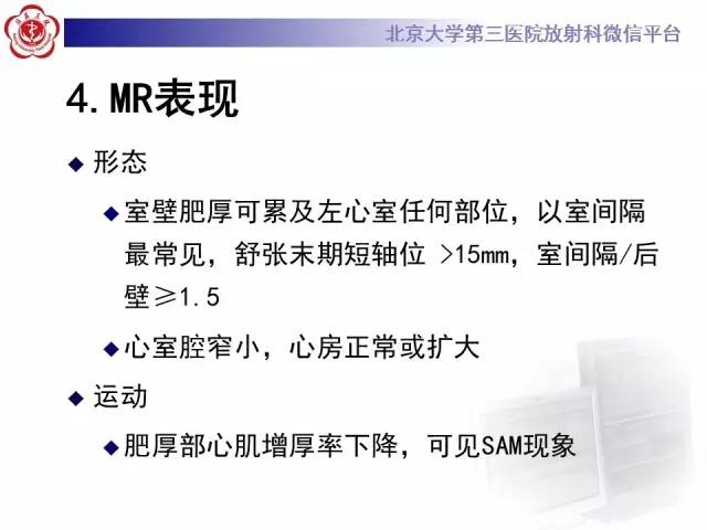 【病例】肥厚性心肌病1例MR影像表现