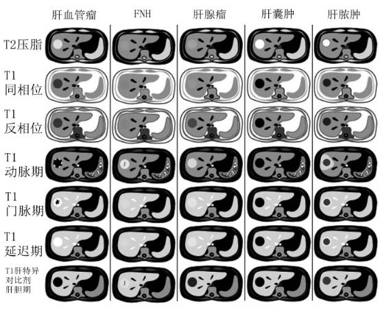 快速入门手册——肝脏占位MRI 快速入门手册——肝脏占位MRI