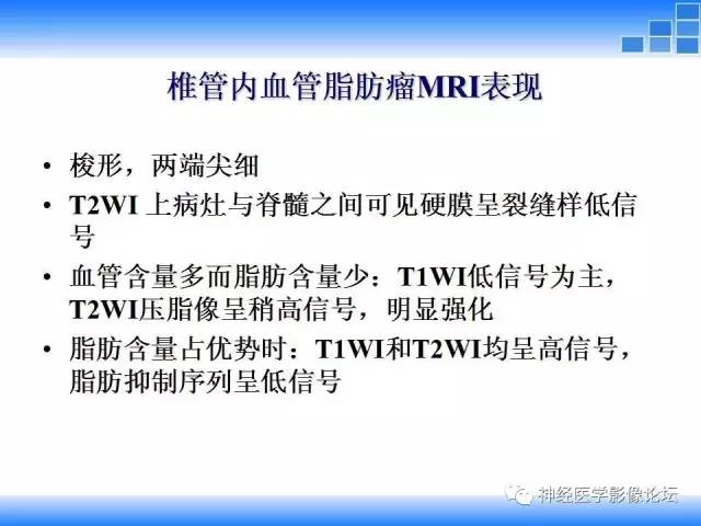 【病例】胸椎椎管内硬膜外血管脂肪瘤1例MR