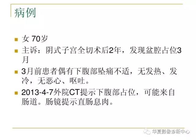 【病例】小肠间质瘤1例MR影像表现