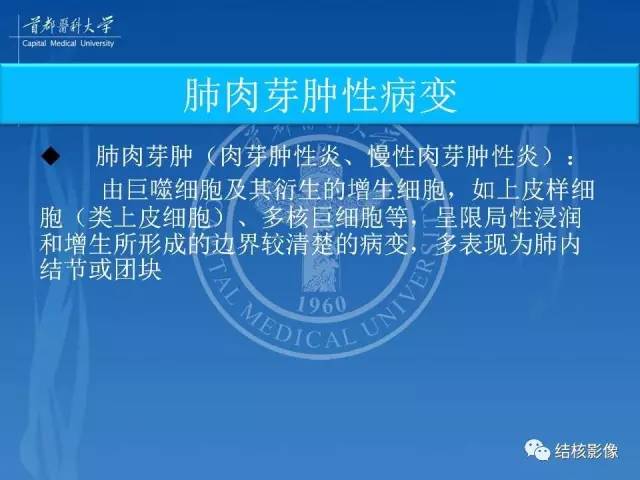 【PPT】肺肉芽肿病变的影像表现和病理基础