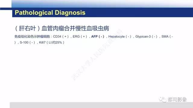 【PPT】肝脏血管肉瘤影像诊断