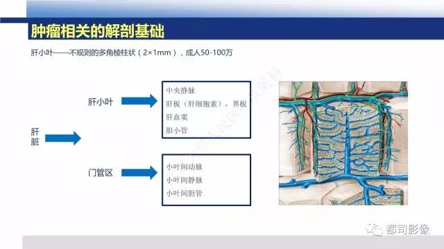 【PPT】肝脏血管肉瘤影像诊断