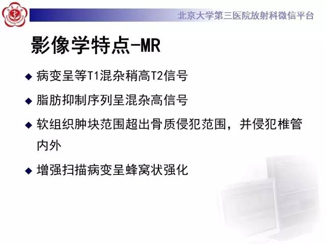 【病例】C2椎体脊索瘤1例CT及MR影像表现