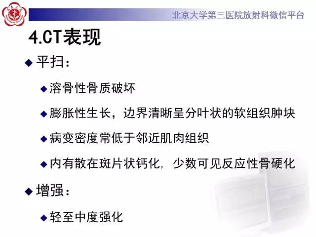 【病例】C2椎体脊索瘤1例CT及MR影像表现