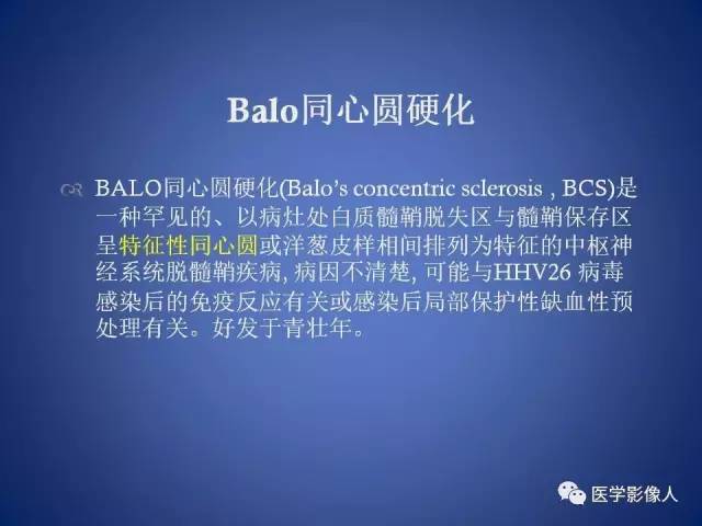 【PPT】脑白质病变的影像学诊断及鉴别诊断