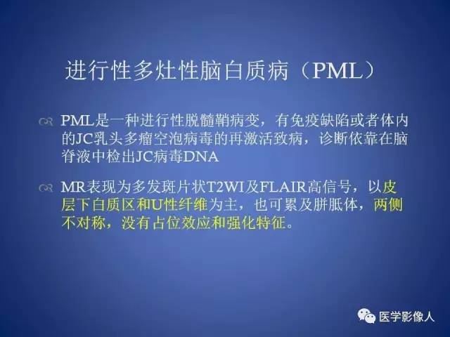【PPT】脑白质病变的影像学诊断及鉴别诊断