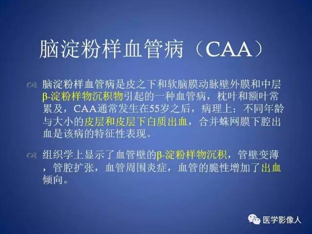 【PPT】脑白质病变的影像学诊断及鉴别诊断