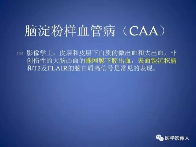 【PPT】脑白质病变的影像学诊断及鉴别诊断