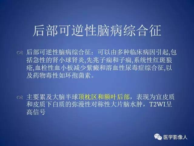 【PPT】脑白质病变的影像学诊断及鉴别诊断