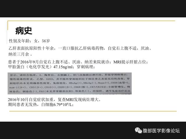 【病例】肝胆管细胞癌1例MR影像表现 【病例】肝胆管细胞癌1例MR影像表现