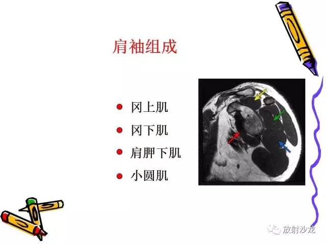 【PPT】肩关节常见创伤性病变