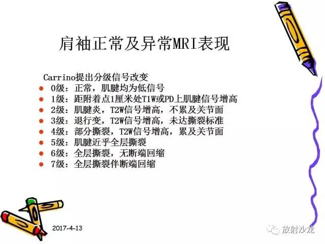 【PPT】肩关节常见创伤性病变