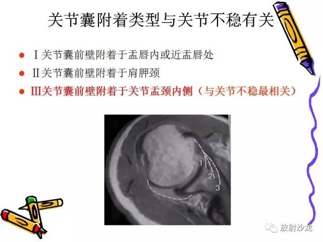 【PPT】肩关节常见创伤性病变