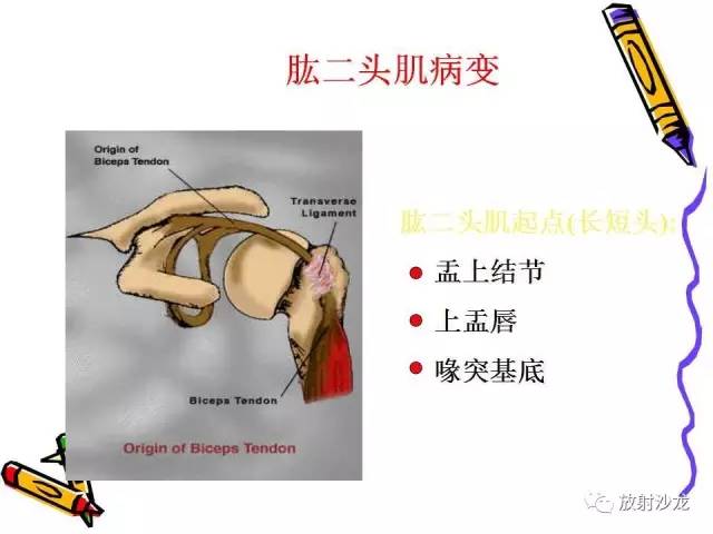 【PPT】肩关节常见创伤性病变