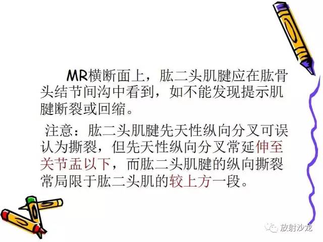 【PPT】肩关节常见创伤性病变
