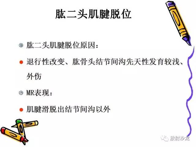 【PPT】肩关节常见创伤性病变