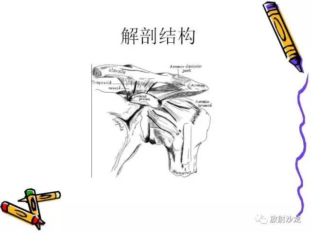 【PPT】肩关节常见创伤性病变