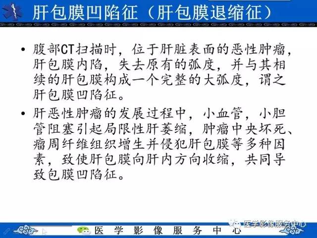 【影像征象】肝包膜凹陷征