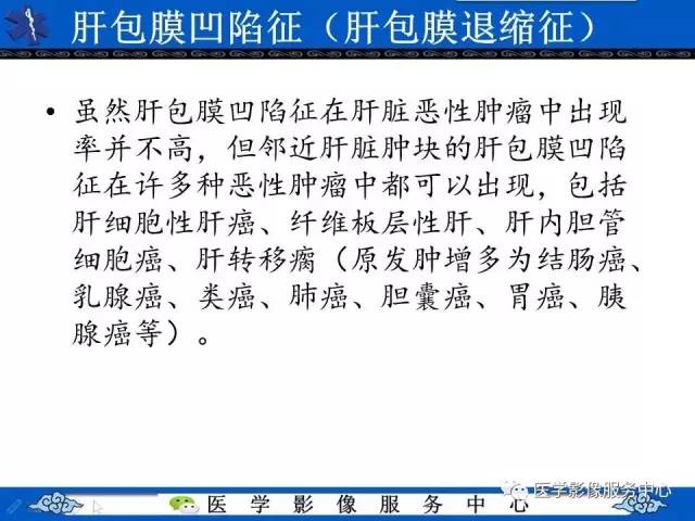 【影像征象】肝包膜凹陷征