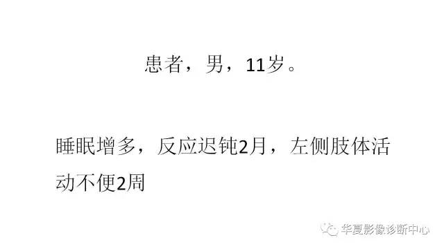 【病例】右侧丘脑畸胎瘤1例CT及MR影像表现