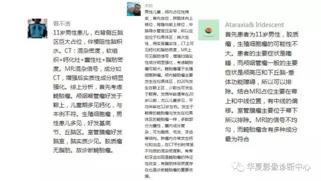 【病例】右侧丘脑畸胎瘤1例CT及MR影像表现