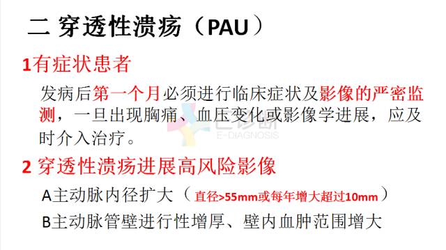 【PPT】急性主动脉综合征CTA诊断及高风险征象评估